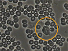 darkfield blood test before cellgen molecular enhancer